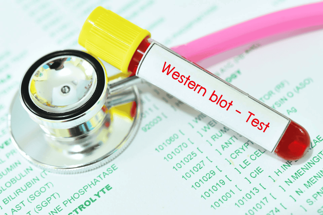 Western Blot Made Simple: A Step-by-Step Protocol with abinScience Antibodies
