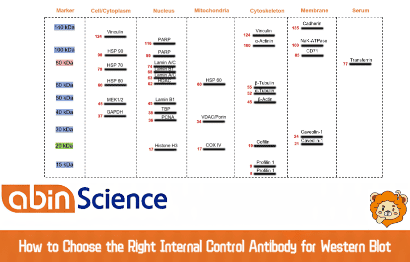 How to Choose the Right Internal Control Antibody for Western Blot