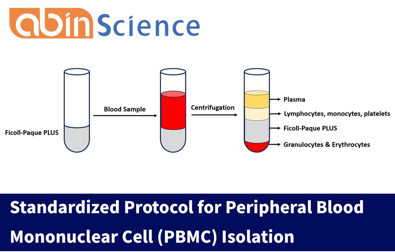 Standardized Protocol for Peripheral Blood Mononuclear Cell (PBMC) Isolation