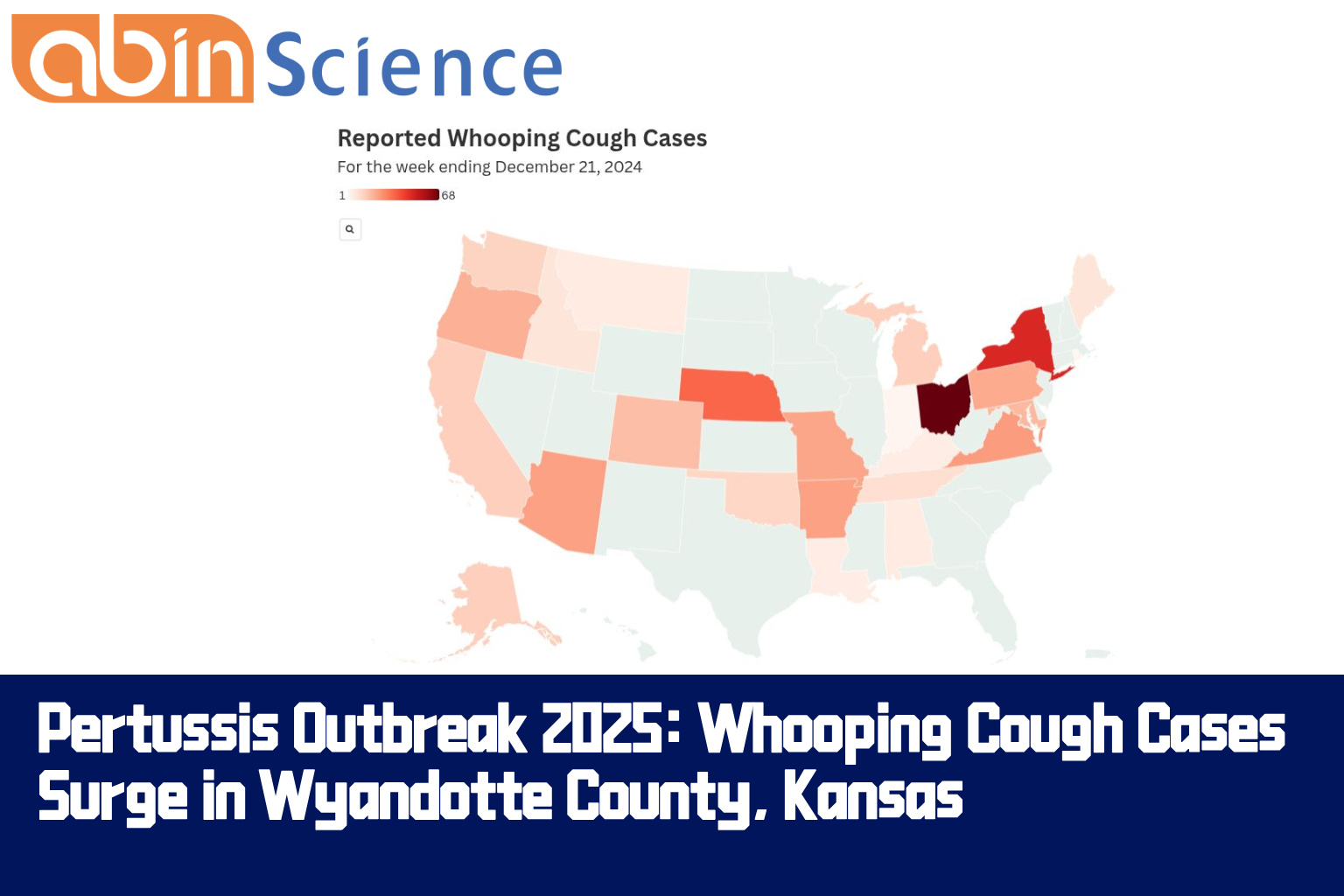 Pertussis Outbreak 2025: Whooping Cough Cases Surge in Wyandotte County, Kansas – abinScience