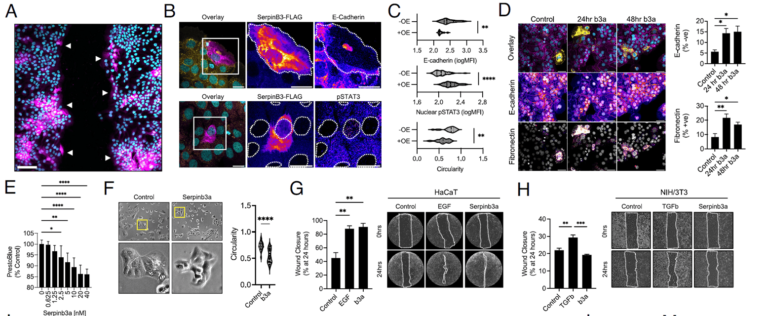 SerpinB3 promotes re-epithelialization by inducing an EMT-like phenotype in keratinocytes