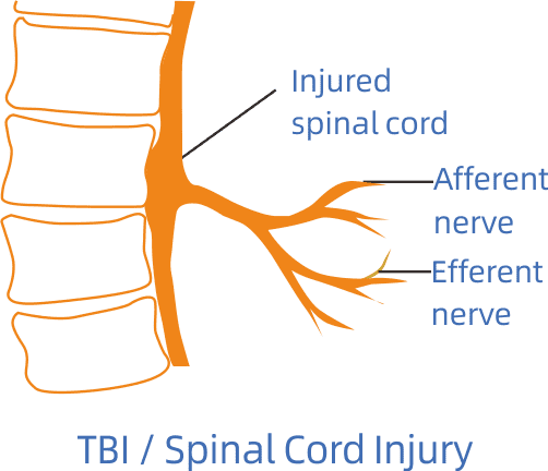 Traumatisme cr&acirc;nien (TBI) / l&eacute;sion de la moelle &eacute;pini&egrave;re