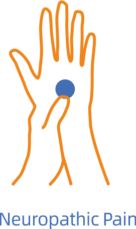 Douleur neuropathique