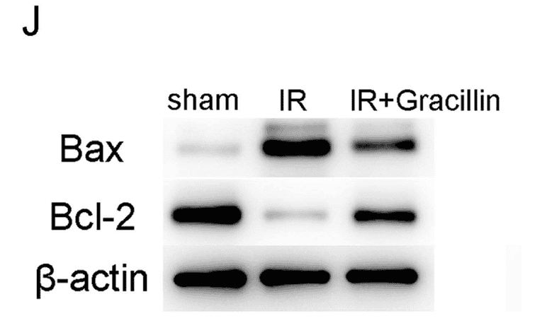 Bcl-2 antibody (Cat# HY131014)