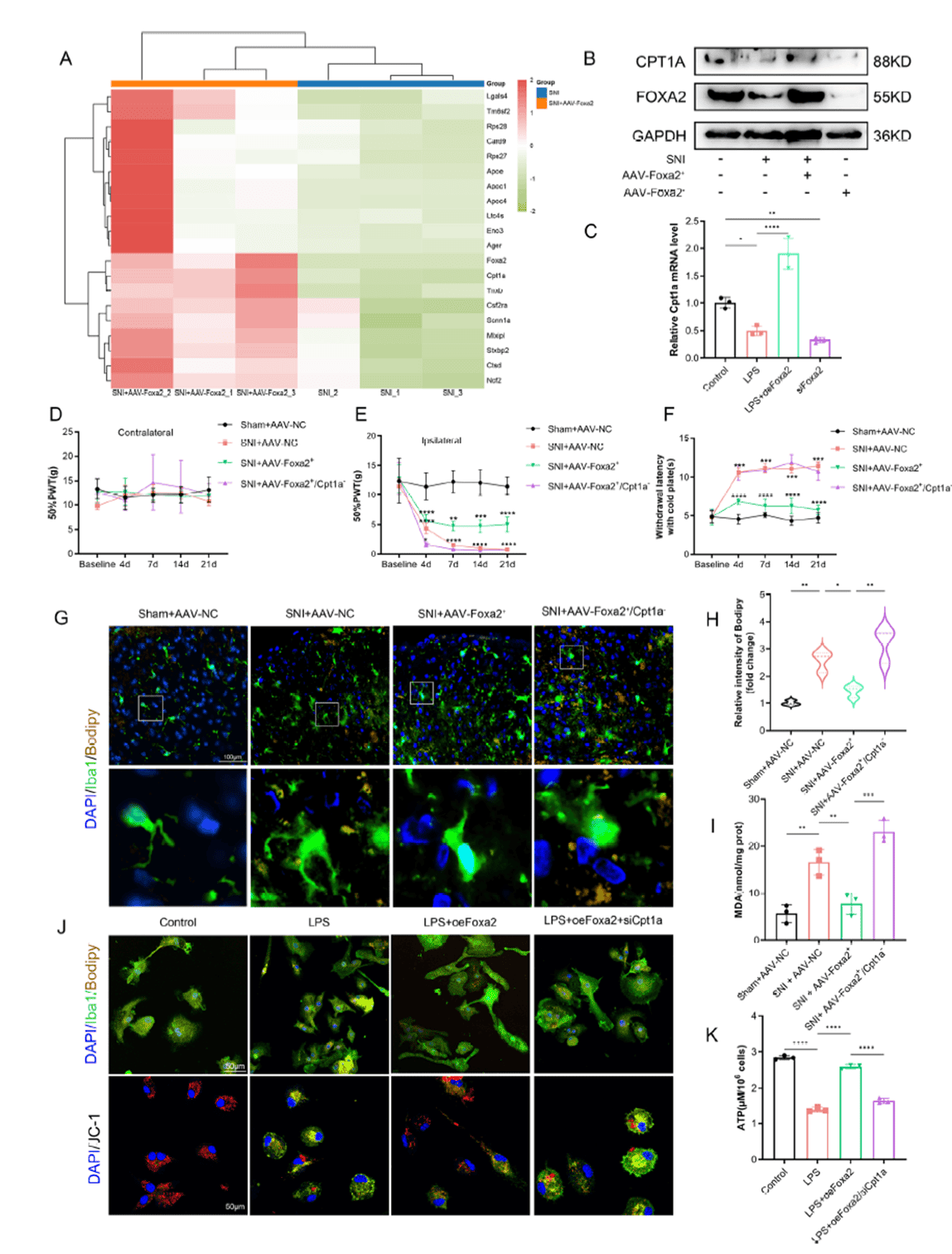 FOXA2 regulates microglial lipid metabolism and synaptic pruning through CPT1A