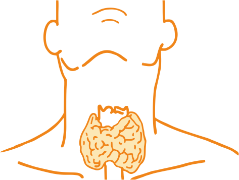 Hashimoto’s Thyroiditis