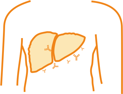 Autoimmune Hepatitis