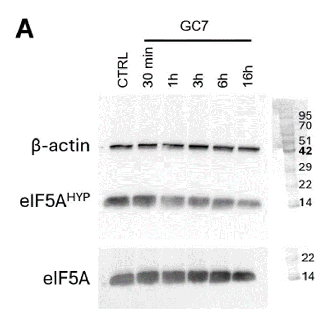 Time dependent inhibition of eIF5A hypusination by GC7 and its cellular effect in INS-1 cells.