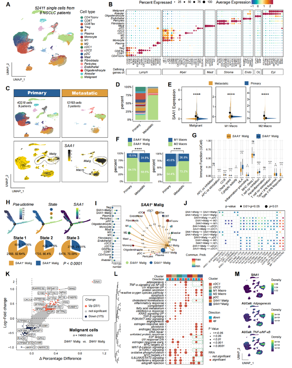 Single-cell transcriptome analysis and characterization of SAA1+ malignant cells in the NSCLC microenvironment