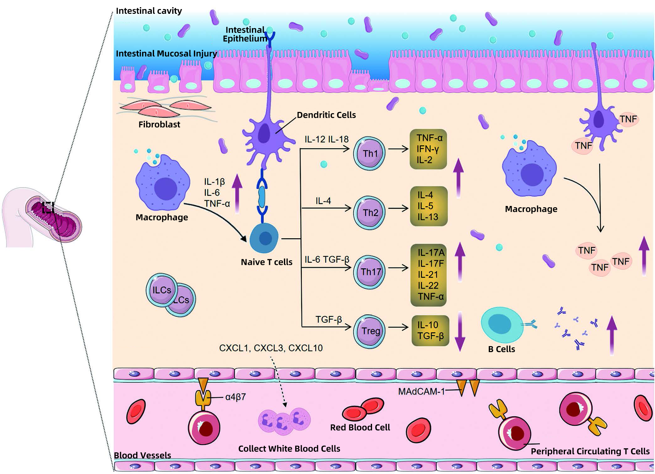 Immunological mechanisms underlying inflammatory bowel disease