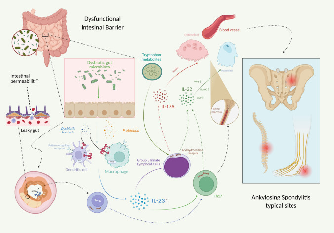 Mechanistic Overview of the Gut-Bone Axis in AS