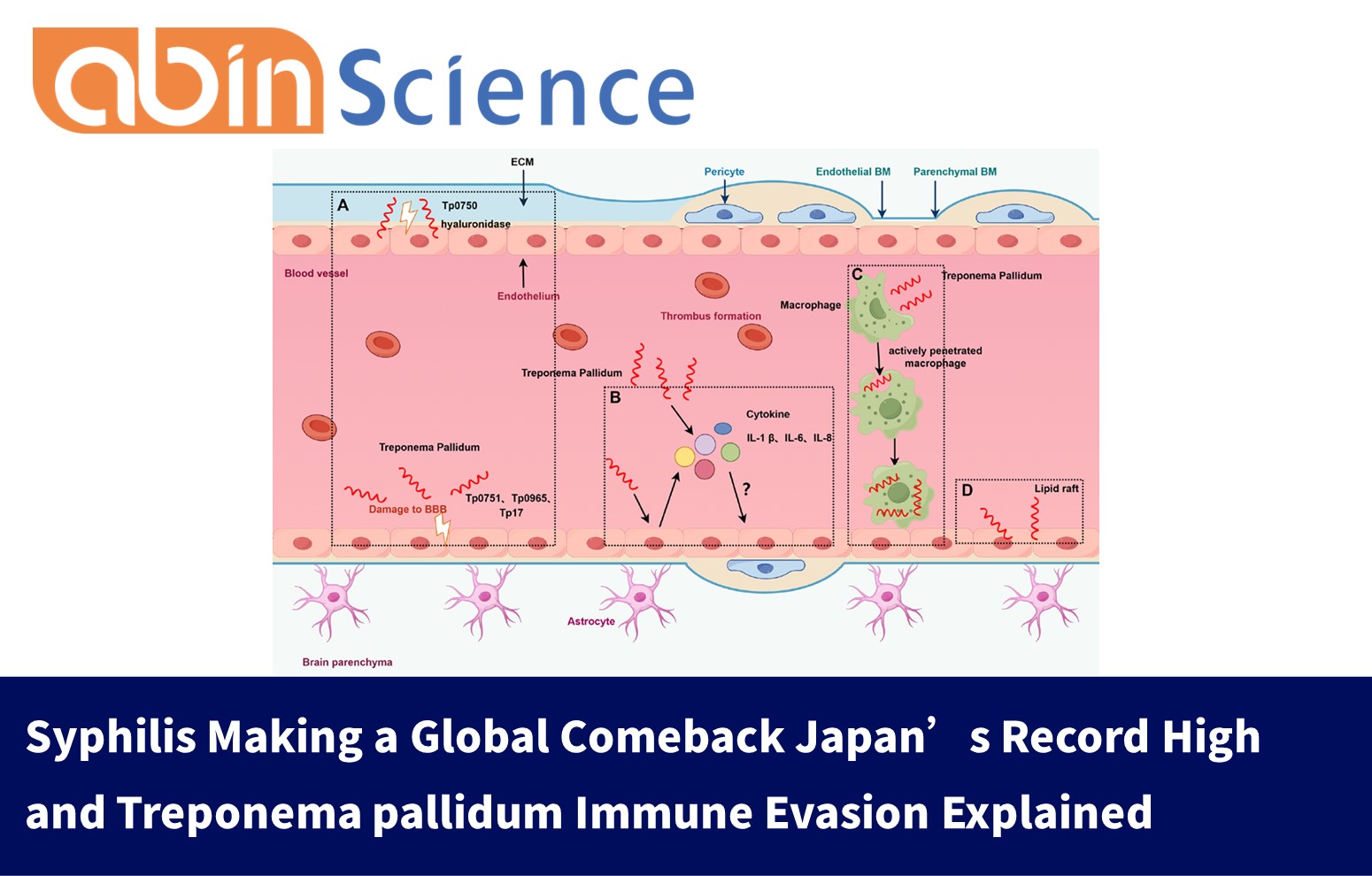 Syphilis Making a Global Comeback Japan&rsquo;s Record High and Treponema pallidum Immune Evasion Explained