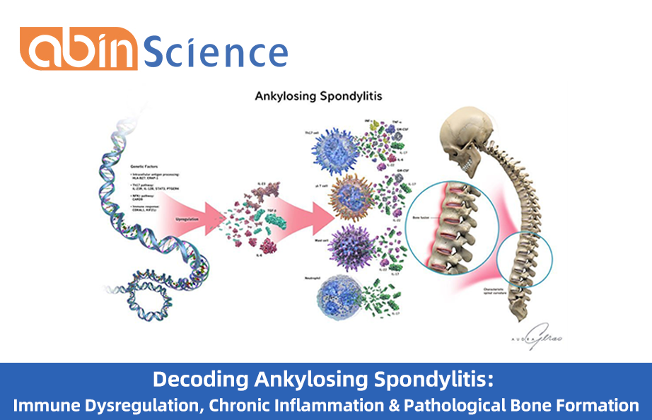 Decoding Ankylosing Spondylitis: Immune Dysregulation, Chronic Inflammation & Pathological Bone Formation