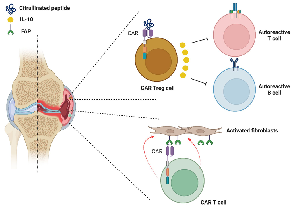 Preclinical CAR-Treg cells and FAP-targeted CAR-T cells for rheumatoid arthritis