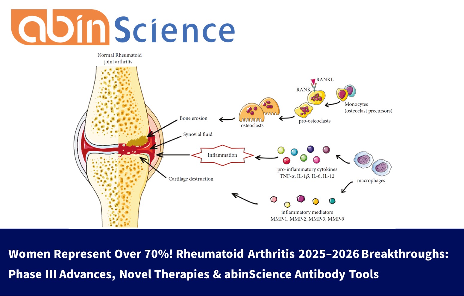 Women Represent Over 70%! Rheumatoid Arthritis 2025&ndash;2026 Breakthroughs: Phase III Advances, Novel Therapies & abinScience Antibody Tools 