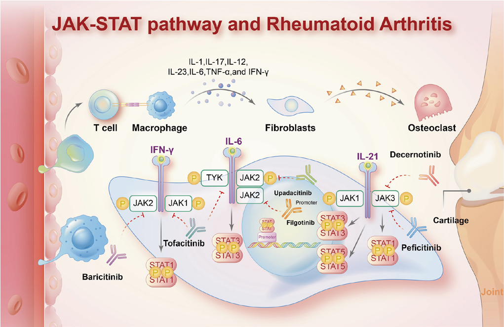 Role of the JAK-STAT pathway in rheumatoid arthritis pathogenesis