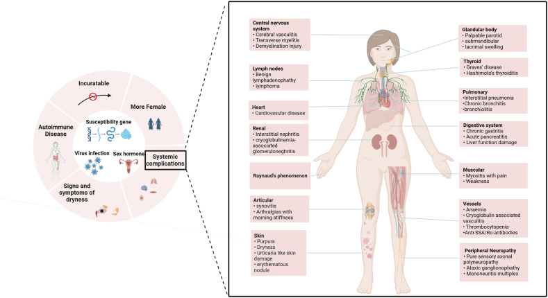 General features of Sjögren's syndrome