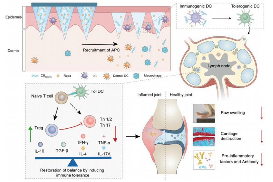 Schematic of microneedle-mediated delivery for RA tolerance induction