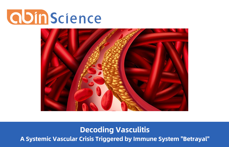 Decoding Vasculitis: A Systemic Vascular Crisis Triggered by Immune System "Betrayal"