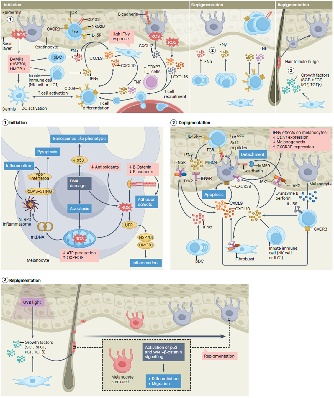 Pathogenesis of vitiligo