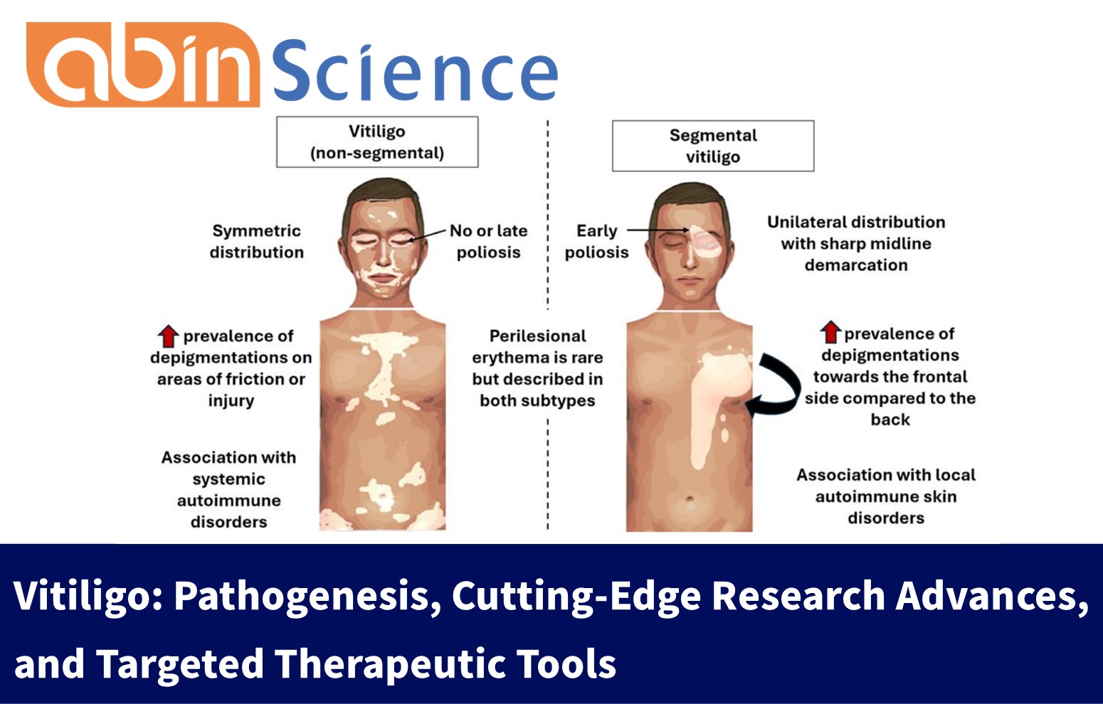 Vitiligo: Pathogenesis, Cutting-Edge Research Advances, and Targeted Therapeutic Tools
