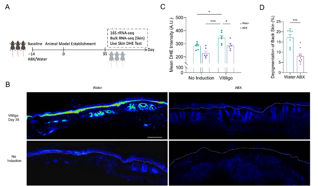 Gut microbiota involvement in vitiligo