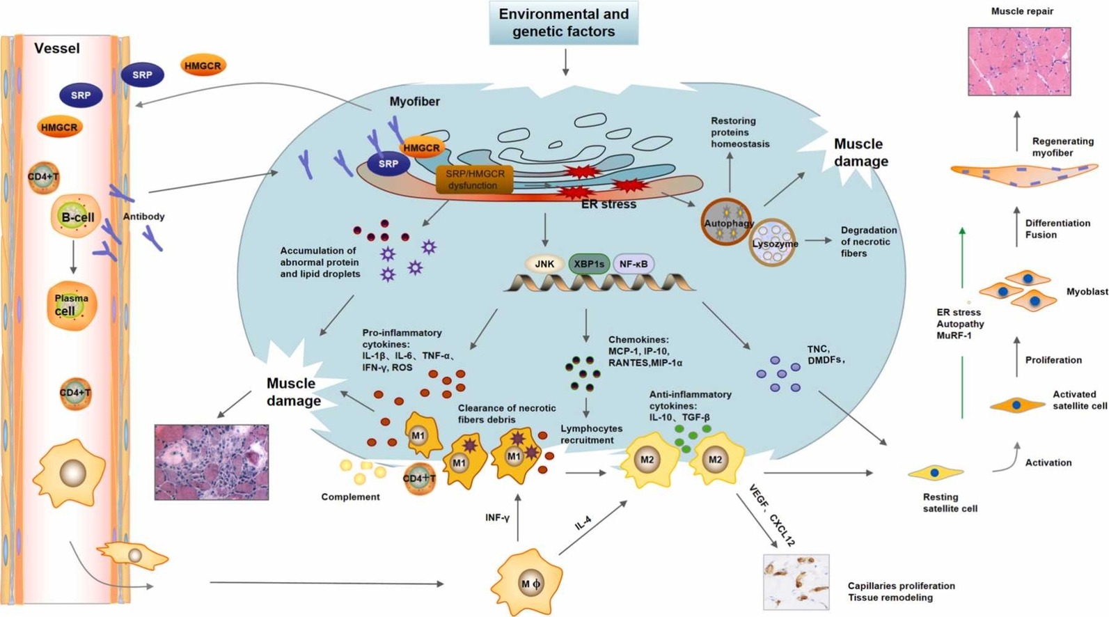 IMNM muscle damage and repair