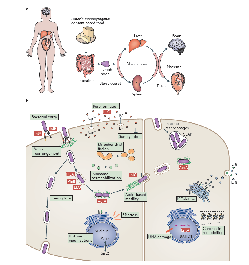 Overview of Listeria monocytogenes infection