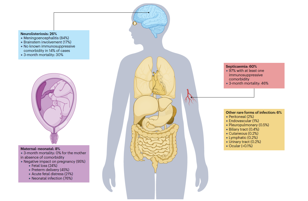 Clinical presentation and features of listeriosis