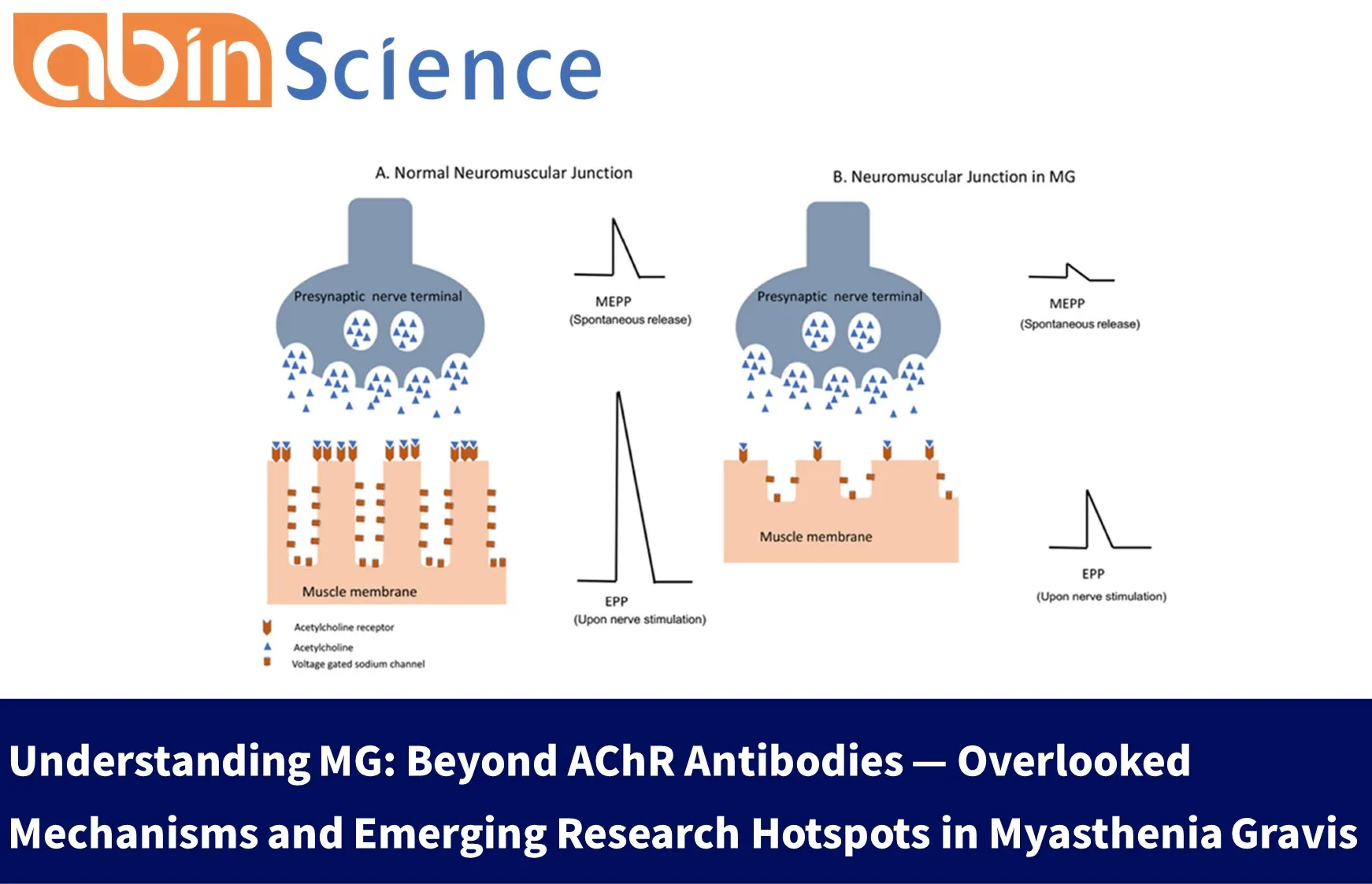 Understanding MG: Beyond AChR Antibodies &mdash; Overlooked Mechanisms and Emerging Research Hotspots in Myasthenia Gravis