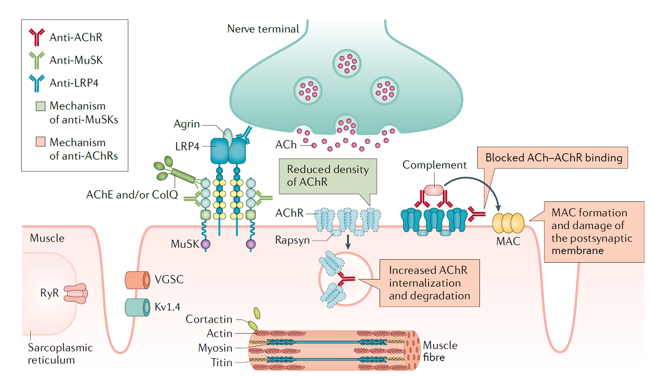 Pathophysiology of MG at the neuromuscular junction