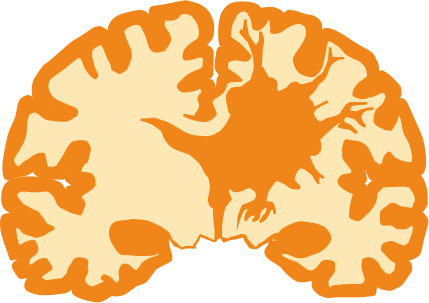 Glioblastoma / Brain Tumors
