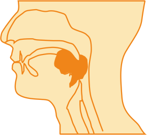 Head and Neck Squamous Cell Carcinoma