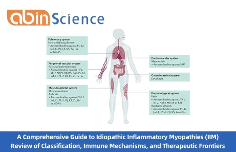 A Comprehensive Guide to Idiopathic Inflammatory Myopathies (IIM) | Review of Classification, Immune Mechanisms, and Therapeutic Frontiers