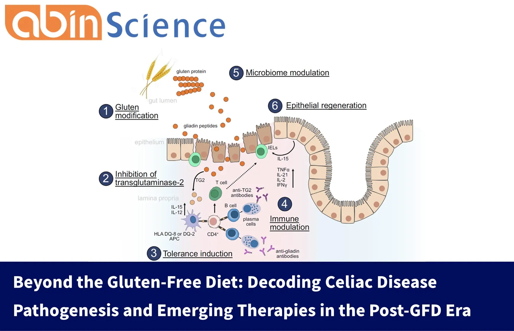 Beyond the Gluten-Free Diet: Decoding Celiac Disease Pathogenesis and Emerging Therapies in the Post-GFD Era