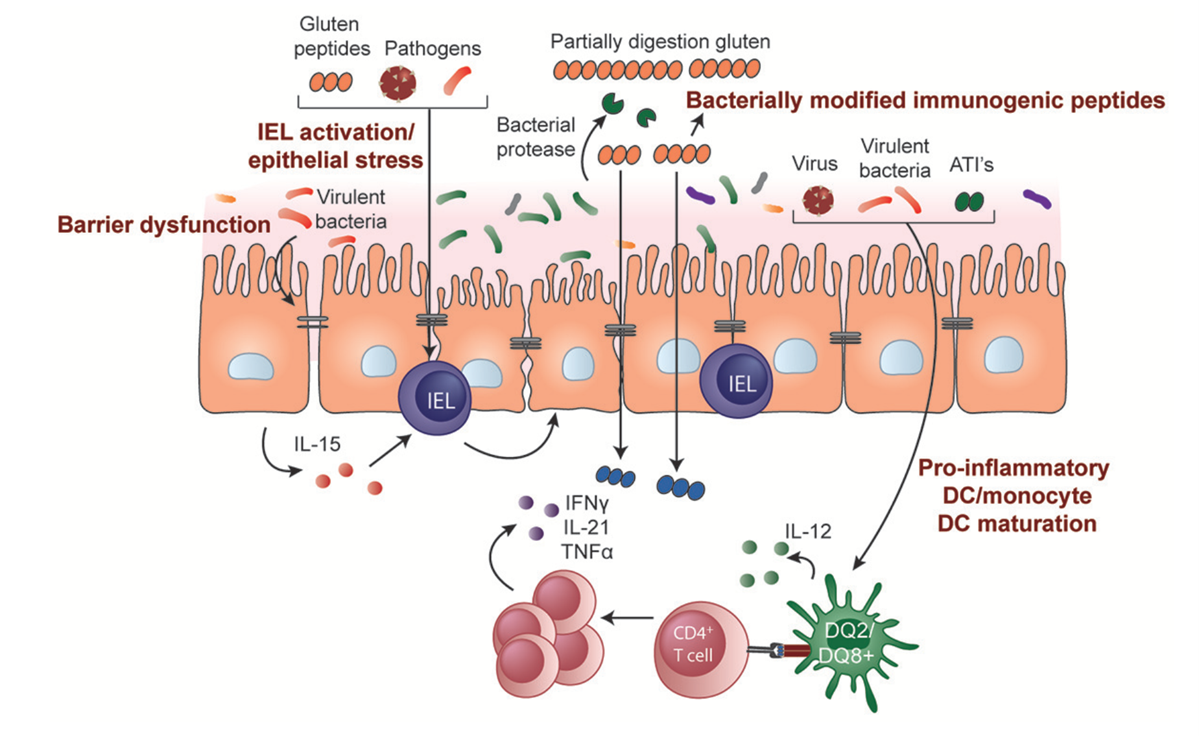 Potential roles of microbiota and environmental triggers in celiac disease pathogenesis