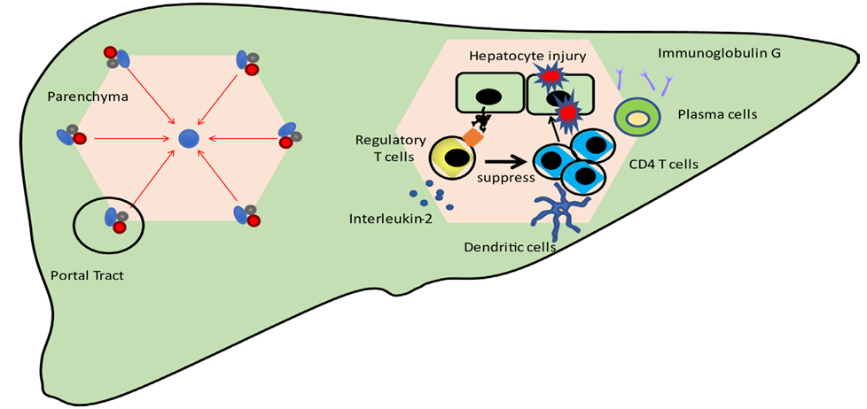 Overview of pathogenesis