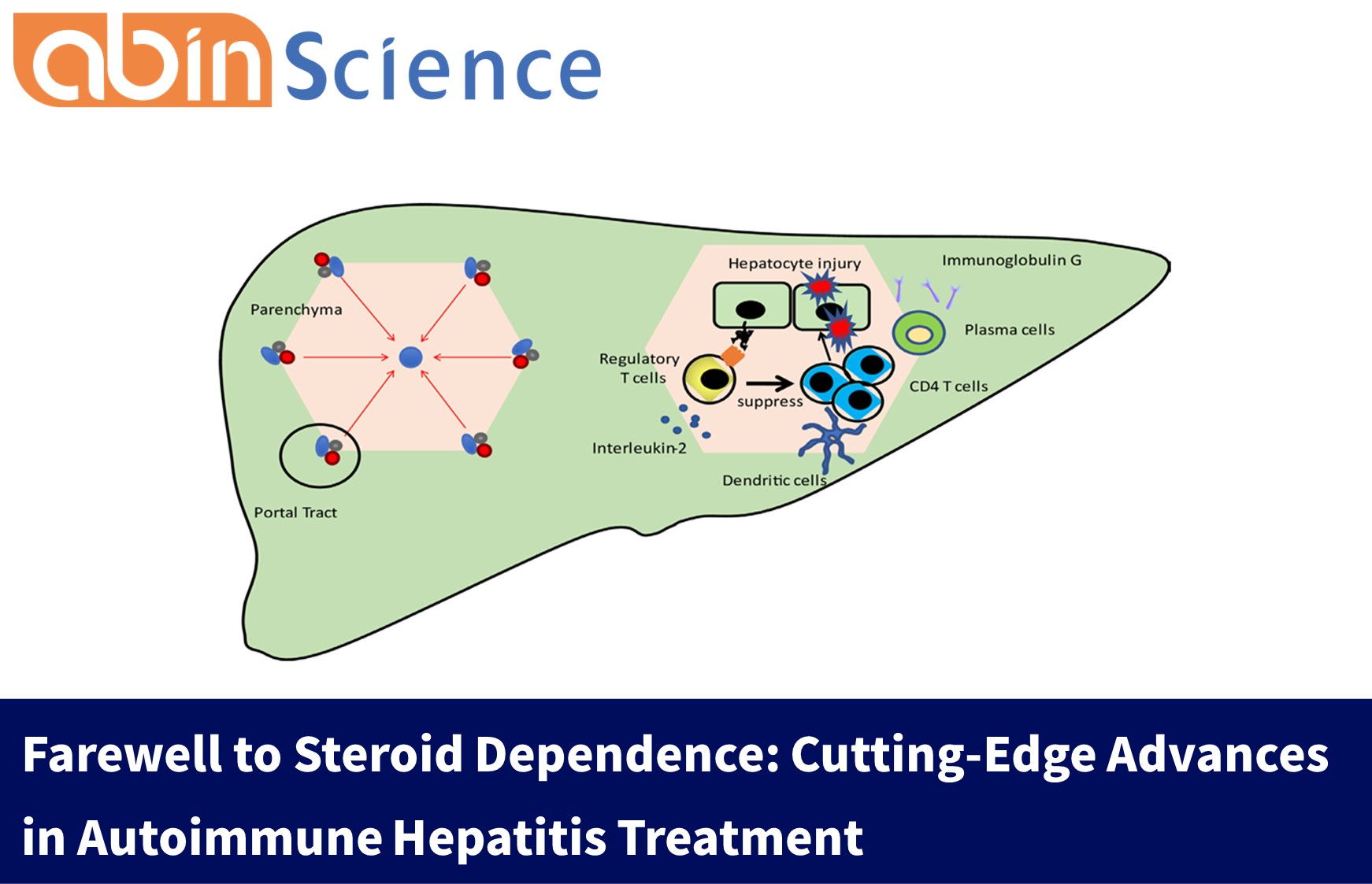 Farewell to Steroid Dependence: Cutting-Edge Advances in Autoimmune Hepatitis Treatment