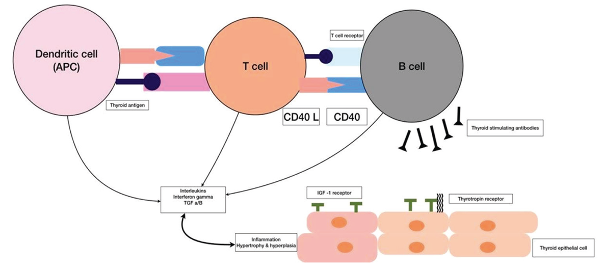 Development of Graves' disease
