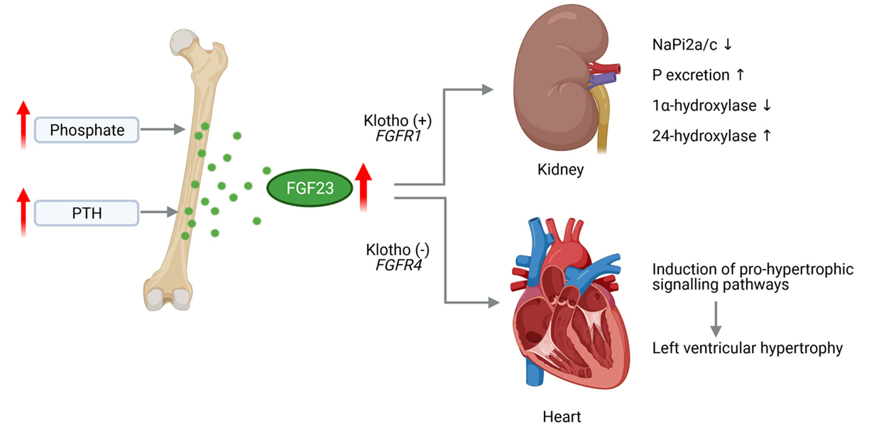Pathological Effects of FGF23 on Kidney and Heart in CKD