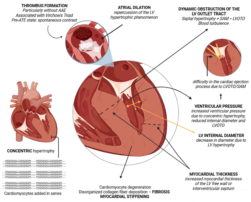 Schematic of Pathophysiology in Feline HCM Phenotype