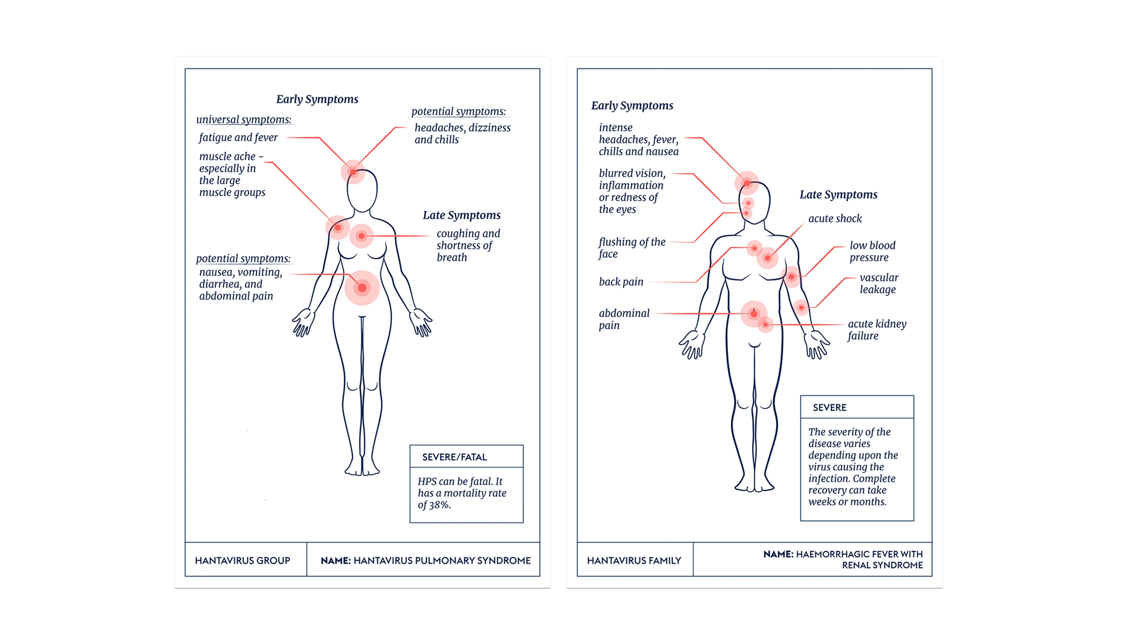 Clinical Features of Hantavirus
