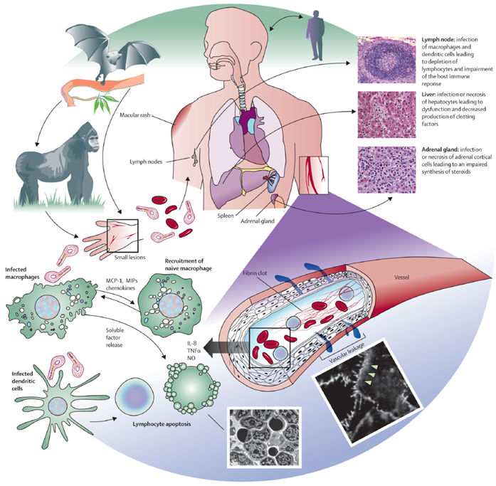 Model of Ebola virus disease pathogenesis
