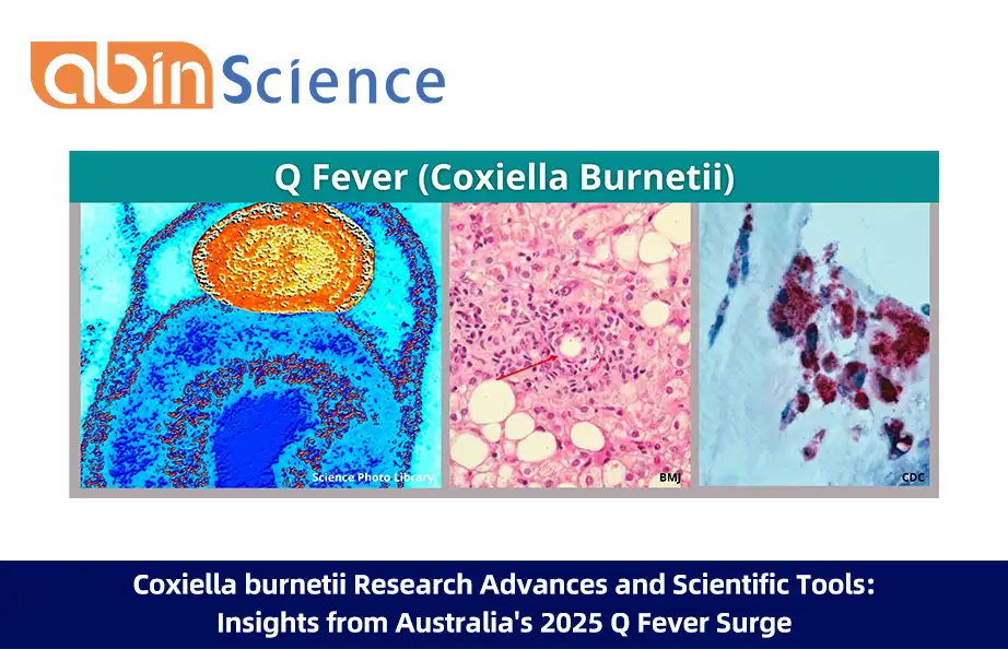 Coxiella burnetii Research Advances and Scientific Tools: Insights from Australia's 2025 Q Fever Surge