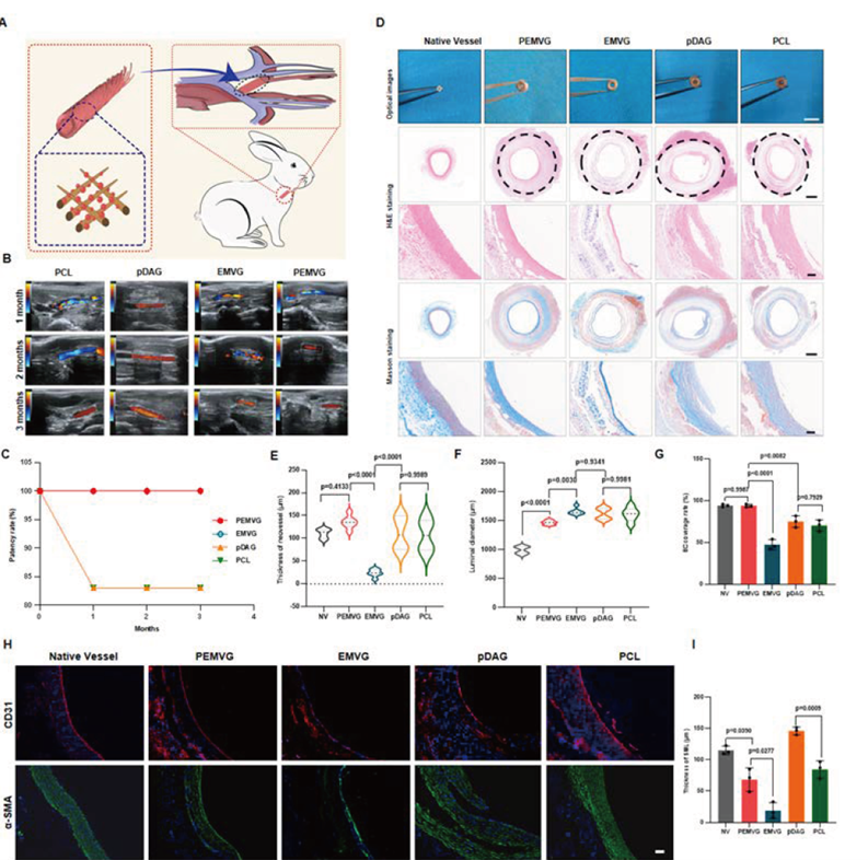 Orthotopic implantation of PEMVG in rabbit carotid arteries