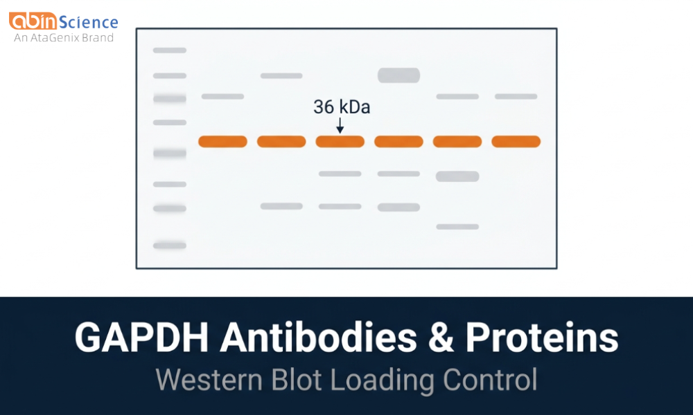 GAPDH Loading Control for Western Blot: Antibody Selection & Protocol Tips