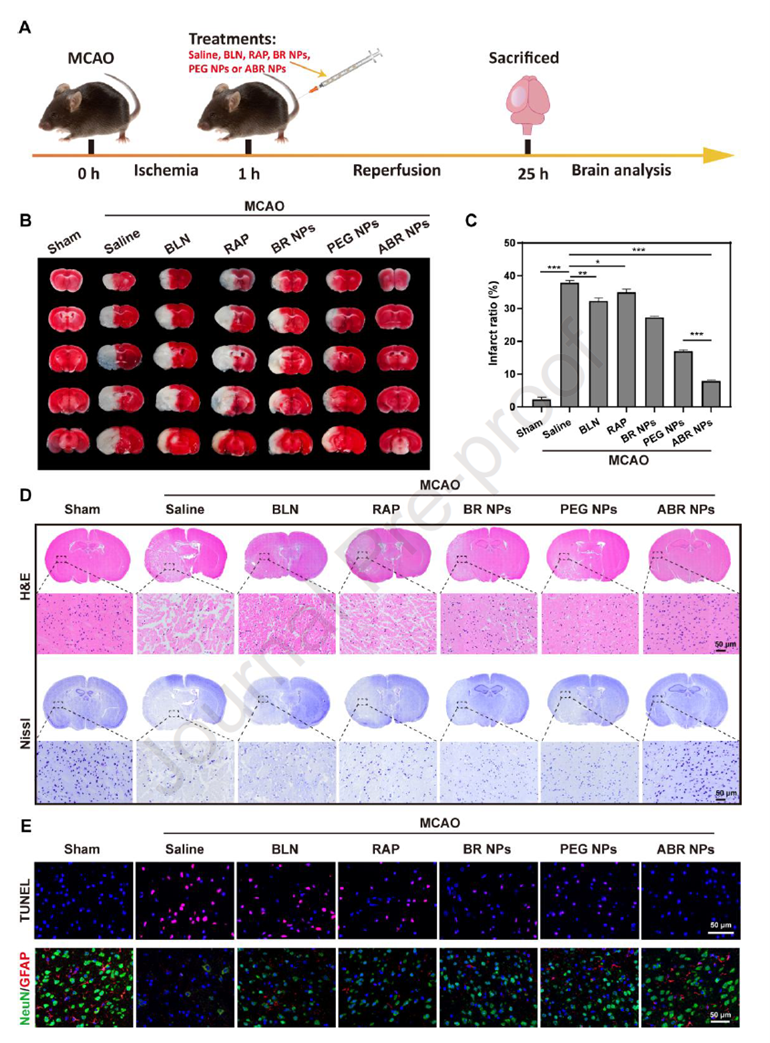 Therapeutic effects of ABR nanoparticles on CIRI