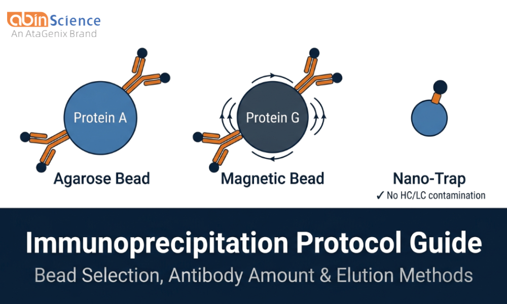 Immunoprecipitation (IP) Protocol: Bead Selection, Antibody Amount & Elution Methods