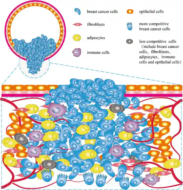 Cellular interactions within the breast cancer microenvironment
