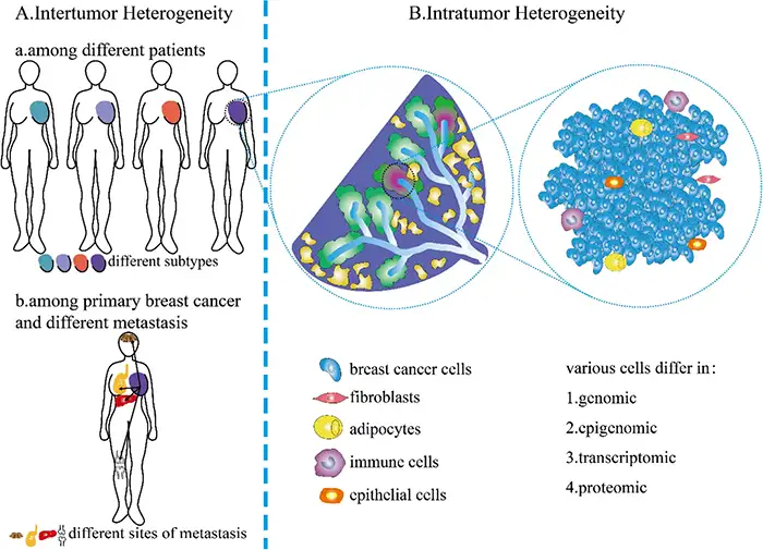 Inter‑ and intratumoral heterogeneity in breast cancer